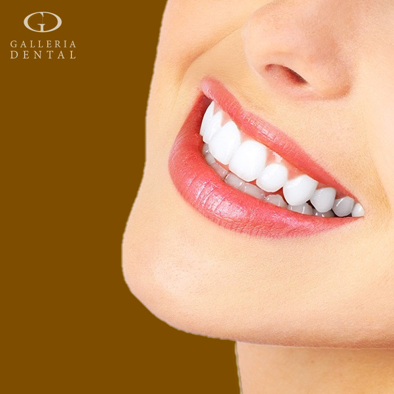Galleria Dental 